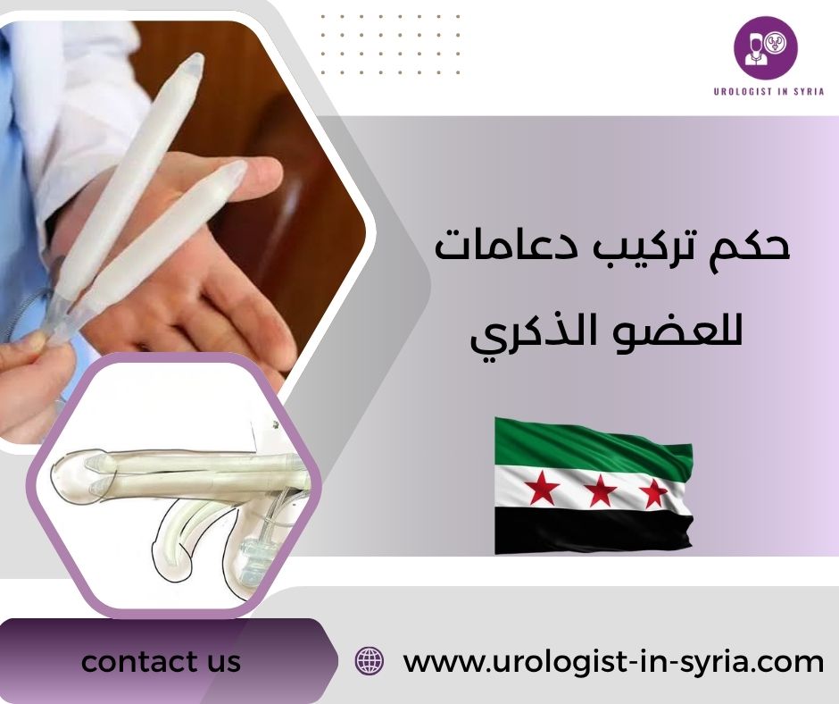 حكم تركيب دعامات للعضو الذكري حكم تركيب دعامات للعضو الذكري