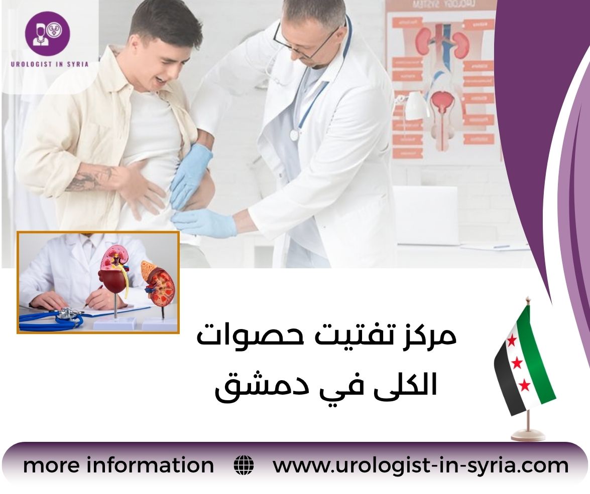 مركز تفتيت حصوات الكلى في دمشق