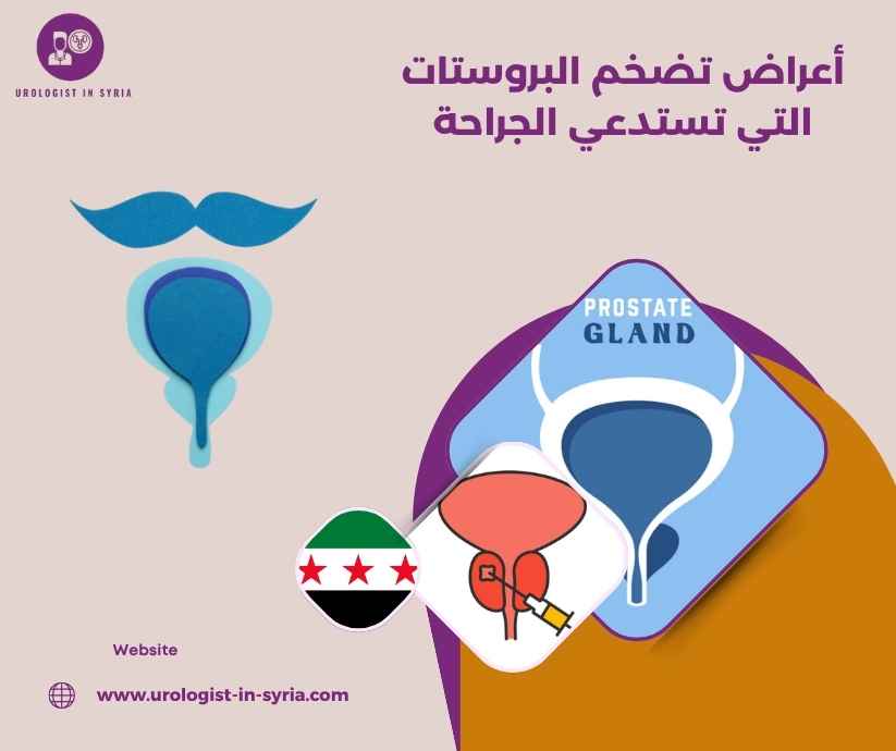 أعراض تضخم البروستات التي تستدعي الجراحة