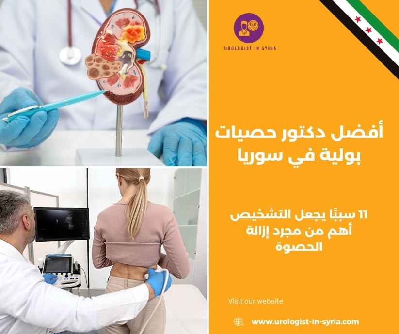 أفضل دكتور حصيات بولية في سوريا