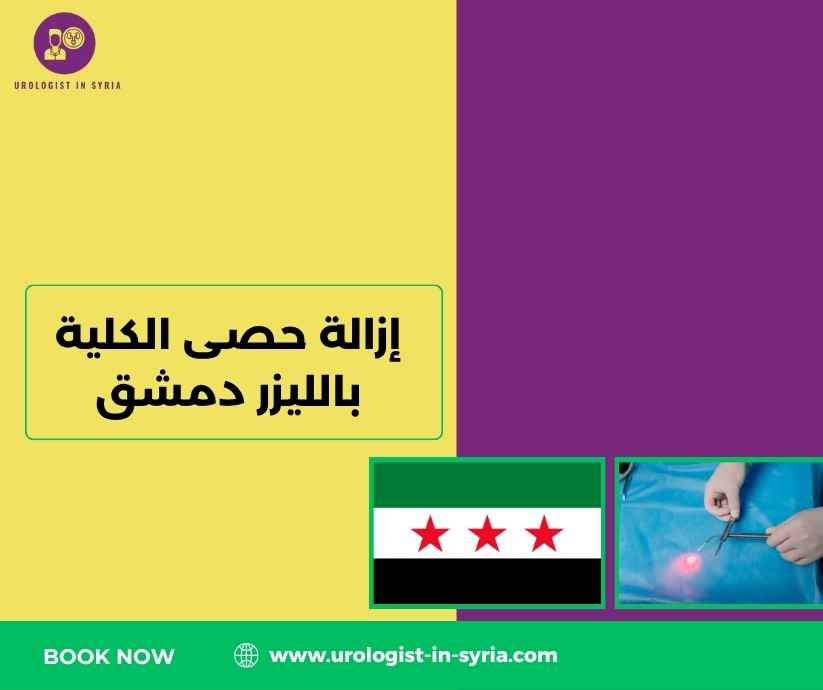 إزالة حصى الكلية بالليزر دمشق