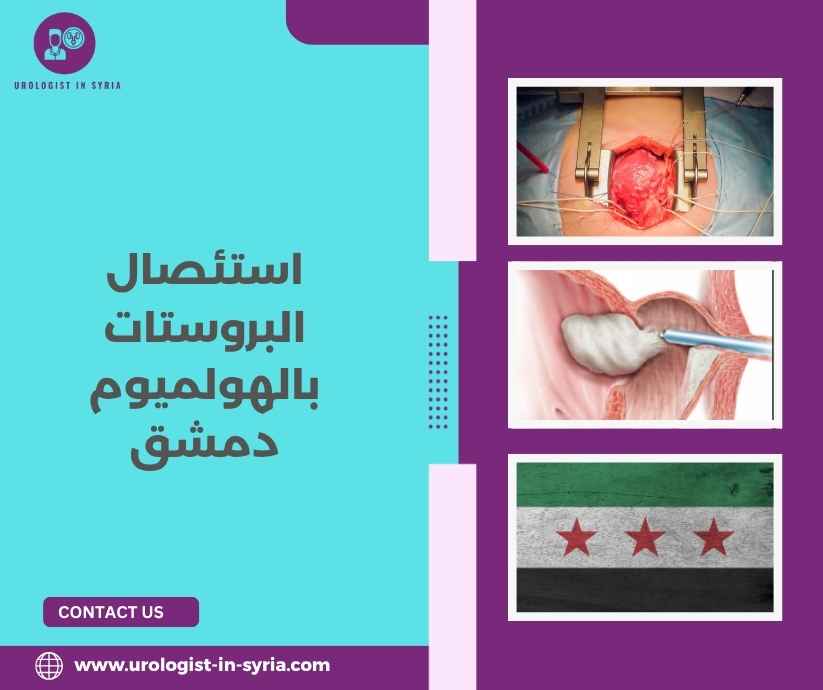 استئصال البروستات بالهولميوم دمشق