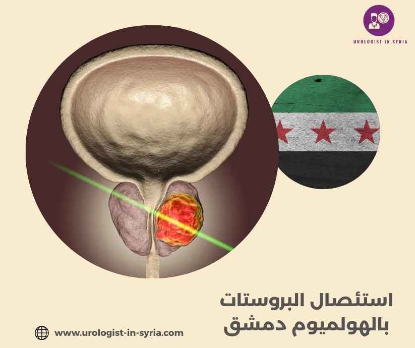 استئصال البروستات بالهولميوم دمشق