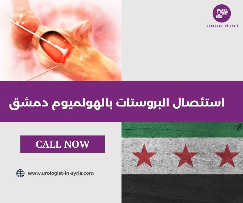 استئصال البروستات بالهولميوم دمشق