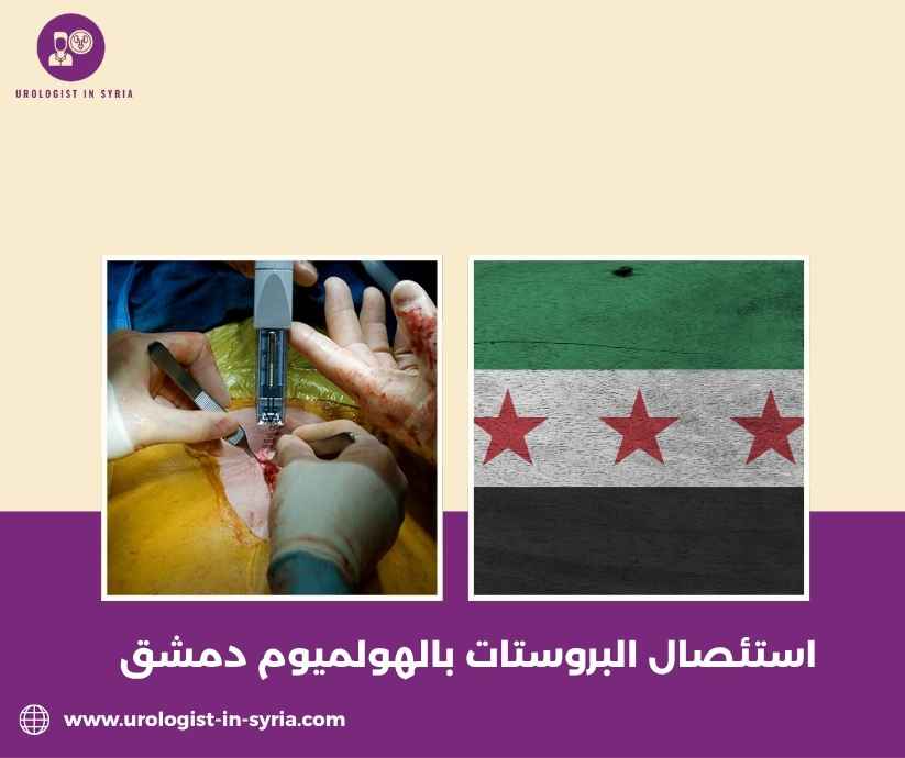 استئصال البروستات بالهولميوم دمشق