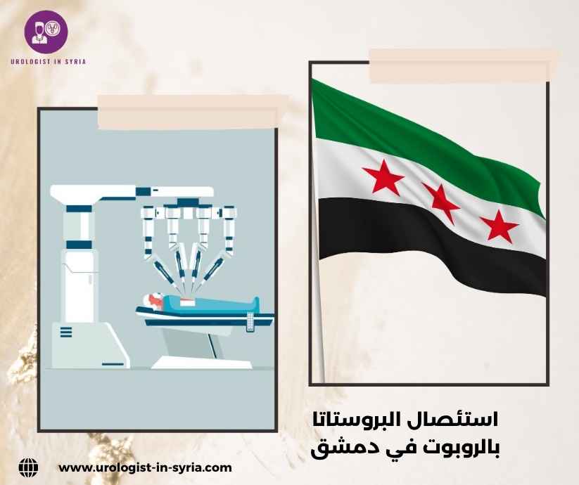 استئصال البروستاتا بالروبوت في دمشق