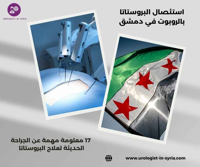 استئصال البروستاتا بالروبوت في دمشق