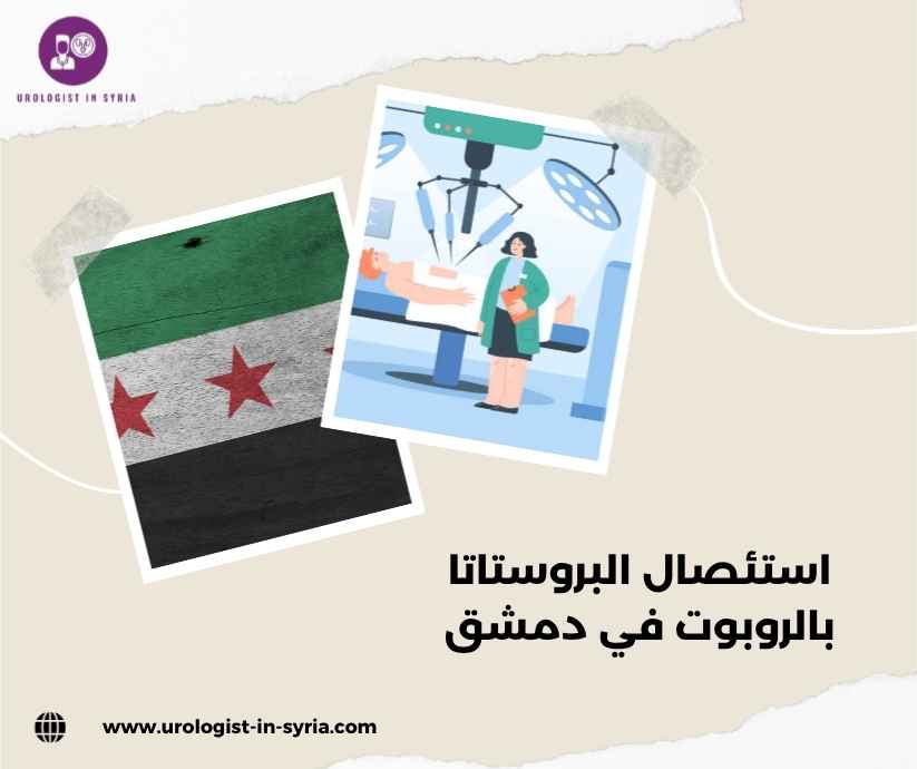 استئصال البروستاتا بالروبوت في دمشق
