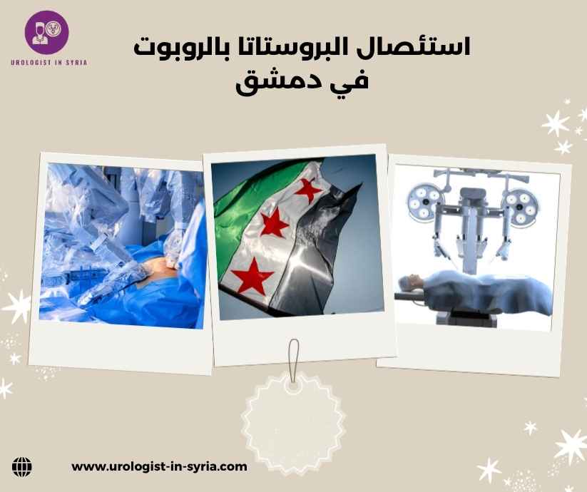 استئصال البروستاتا بالروبوت في دمشق