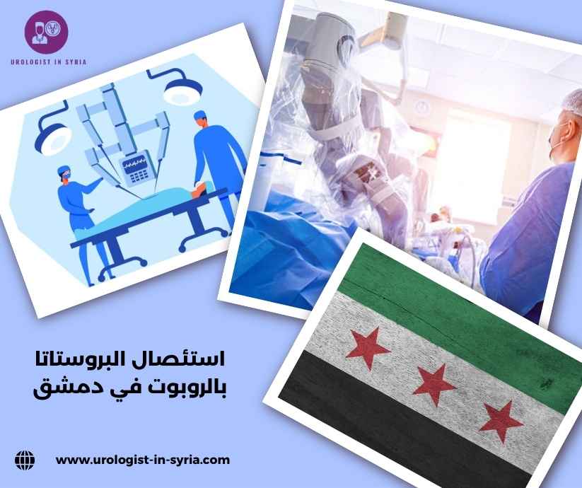 استئصال البروستاتا بالروبوت في دمشق