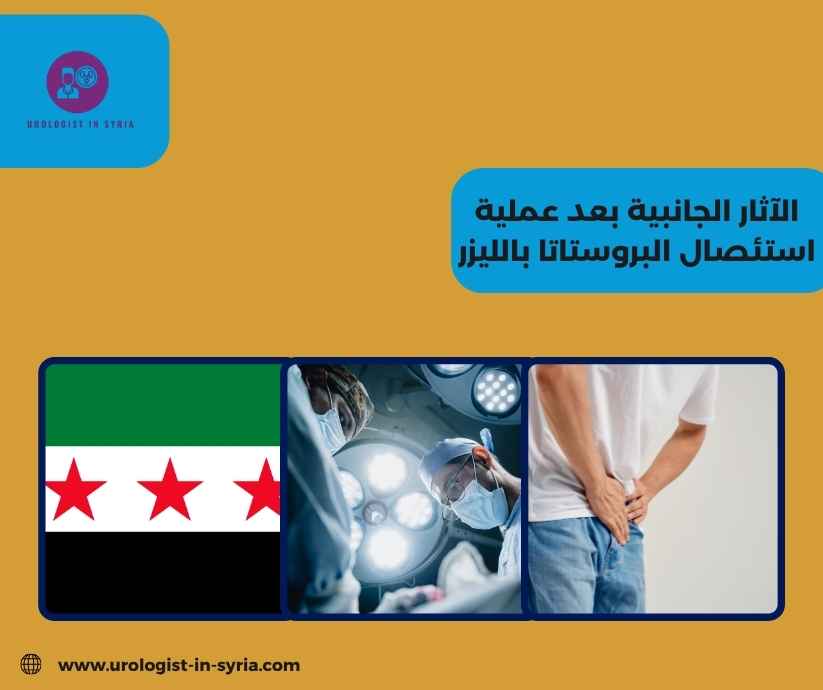 الآثار الجانبية بعد عملية استئصال البروستاتا بالليزر الآثار الجانبية بعد عملية استئصال البروستاتا بالليزر