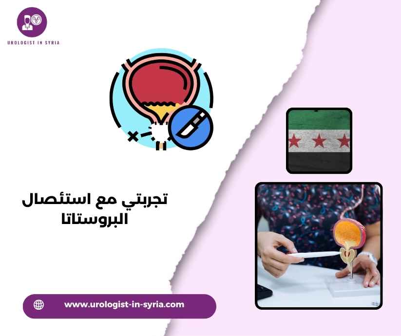 تجربتي مع استئصال البروستاتا تجربتي مع استئصال البروستاتا