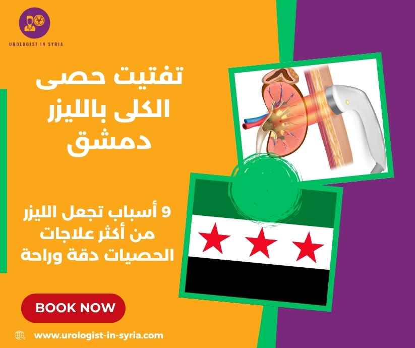 تفتيت حصى الكلى بالليزر دمشق