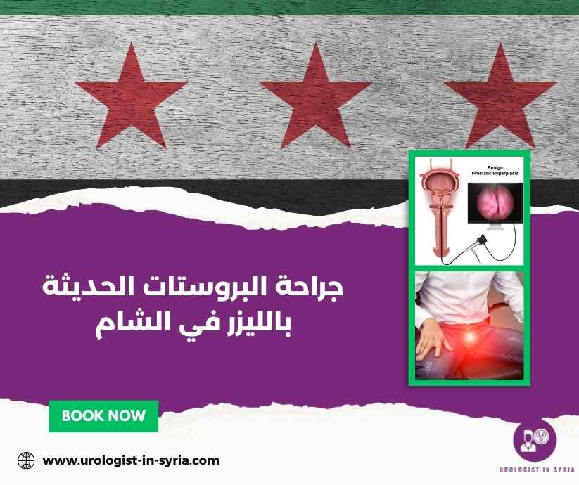 جراحة البروستات الحديثة بالليزر في الشام