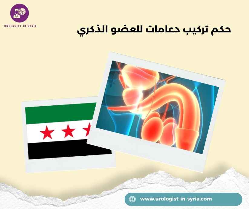 حكم تركيب دعامات للعضو الذكري