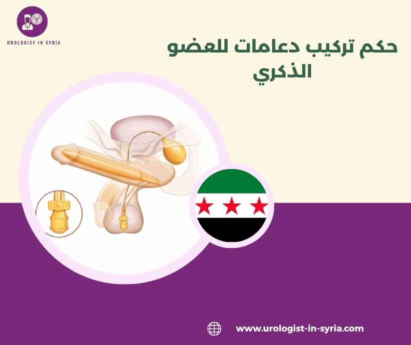 حكم تركيب دعامات للعضو الذكري