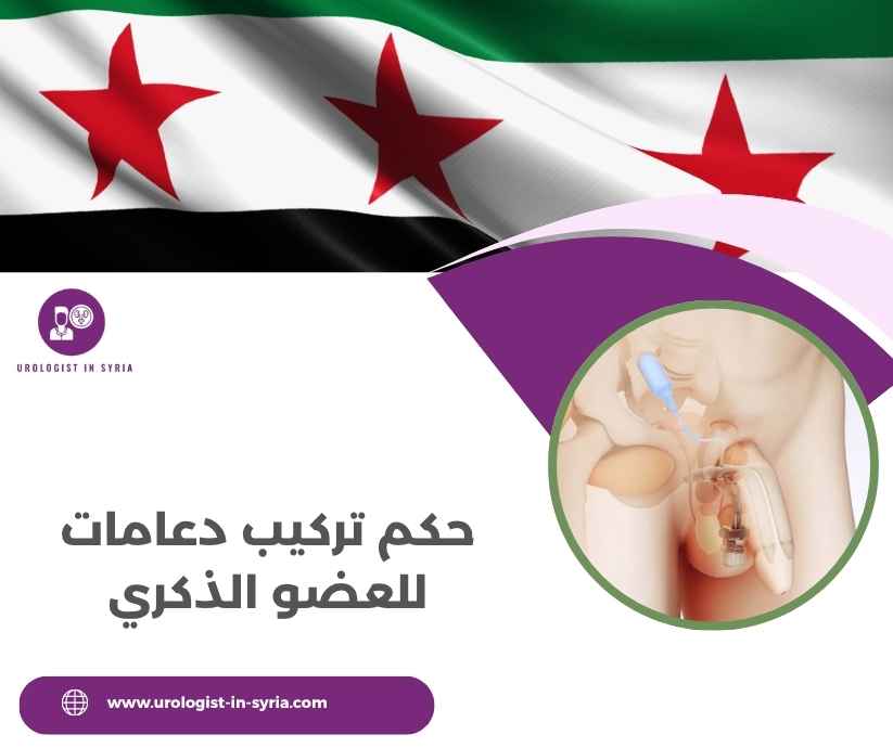حكم تركيب دعامات للعضو الذكري