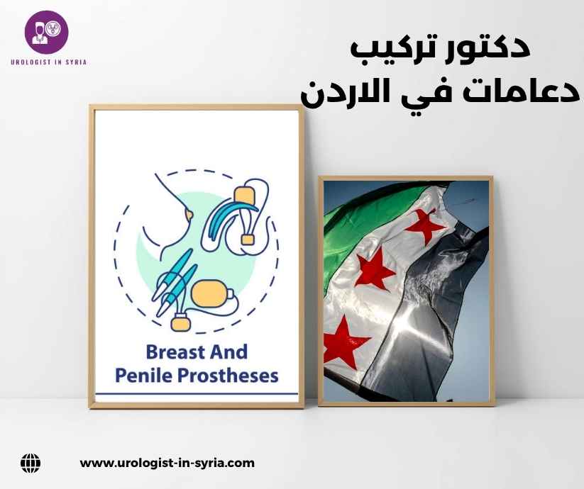 دكتور تركيب دعامات في الاردن