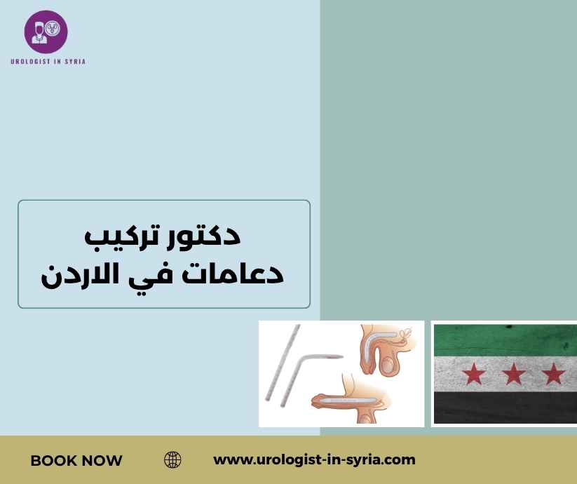 دكتور تركيب دعامات في الاردن