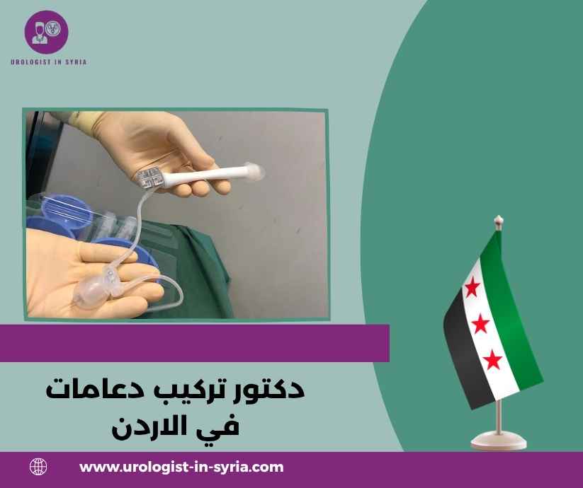 دكتور تركيب دعامات في الاردن