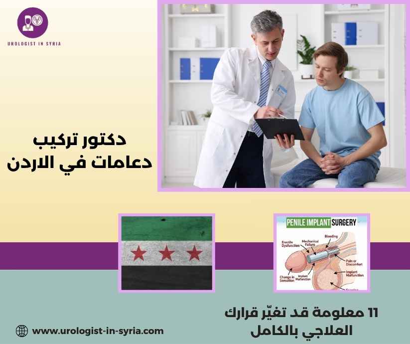 دكتور تركيب دعامات في الاردن