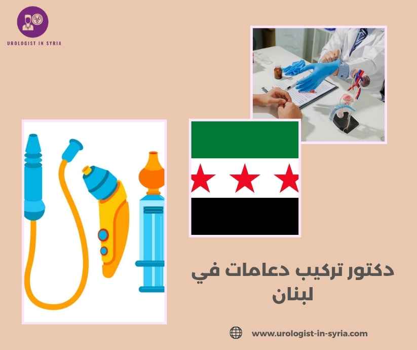 دكتور تركيب دعامات في لبنان