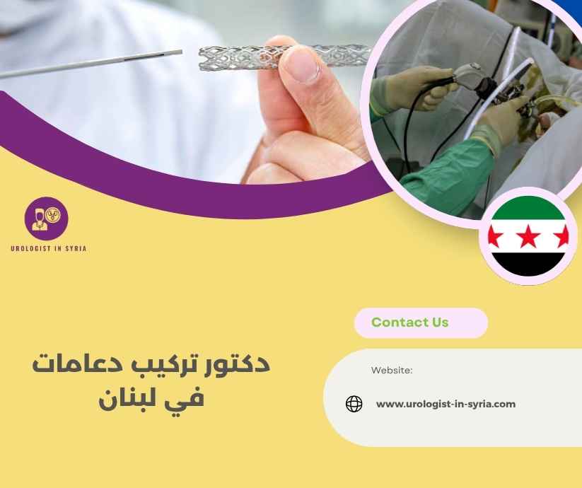 دكتور تركيب دعامات في لبنان