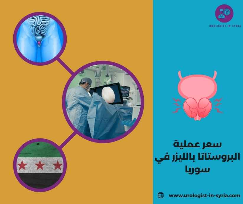 سعر عملية البروستاتا بالليزر في سوريا
