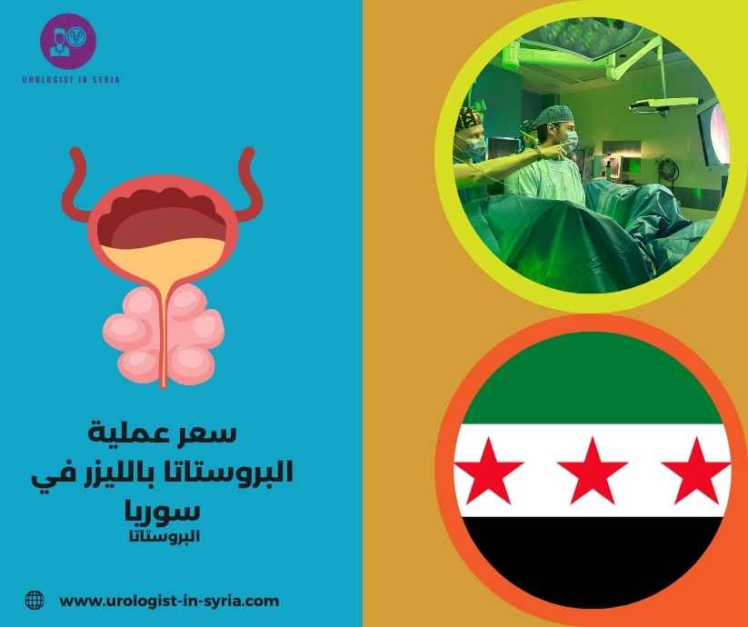 سعر عملية البروستاتا بالليزر في سوريا