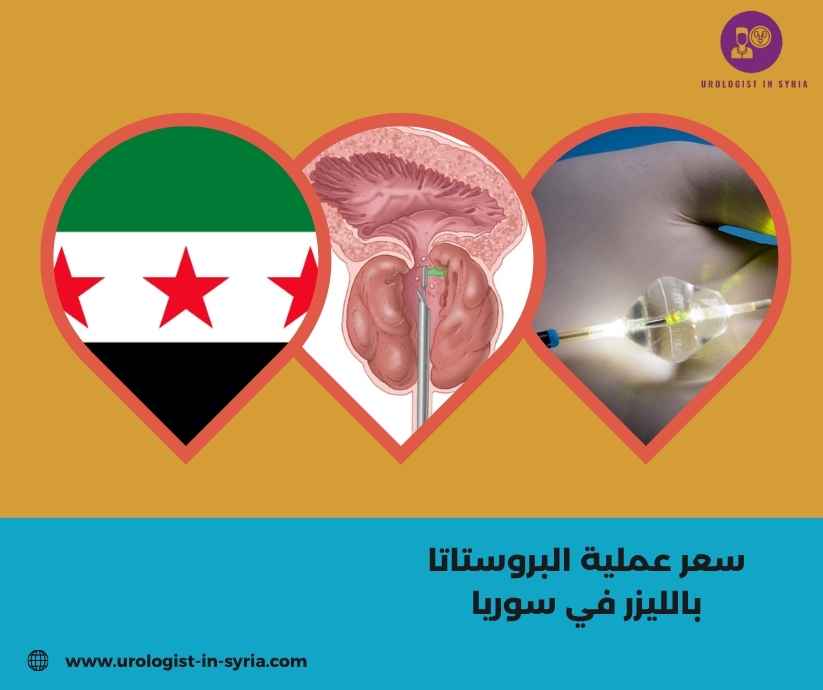 سعر عملية البروستاتا بالليزر في سوريا