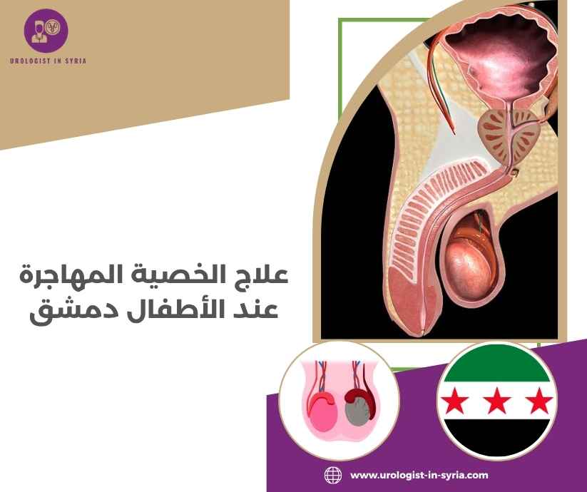 علاج الخصية المهاجرة عند الأطفال دمشق