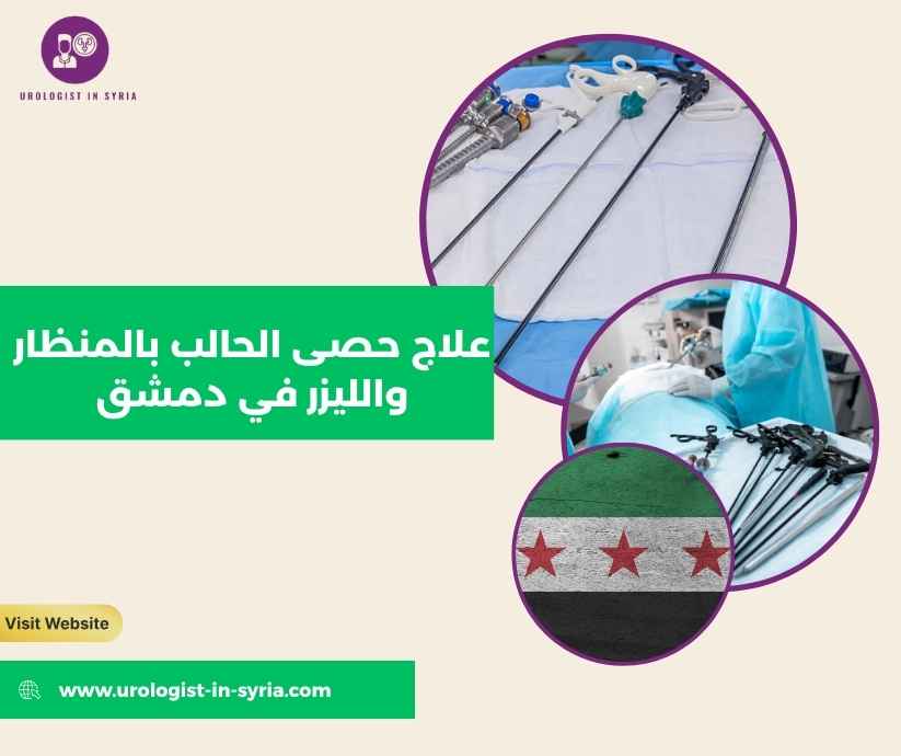 علاج حصى الحالب بالمنظار والليزر في دمشق علاج حصى الحالب بالمنظار والليزر في دمشق