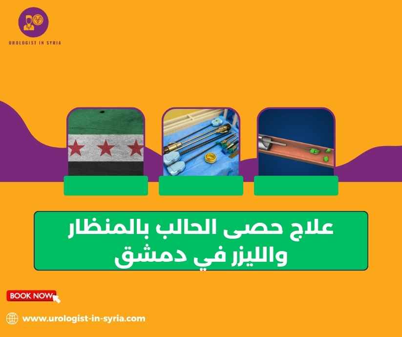 علاج حصى الحالب بالمنظار والليزر في دمشق علاج حصى الحالب بالمنظار والليزر في دمشق