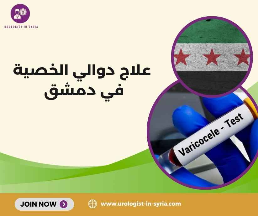 علاج دوالي الخصية في دمشق