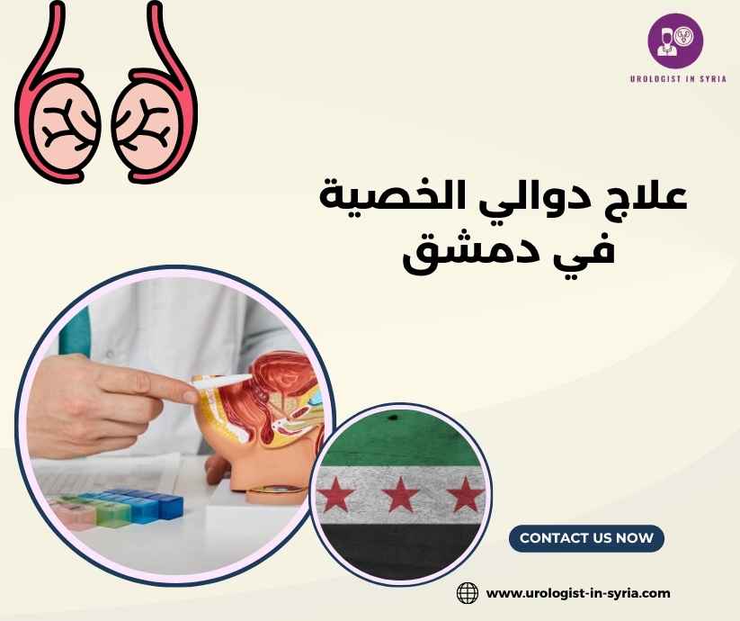 علاج دوالي الخصية في دمشق