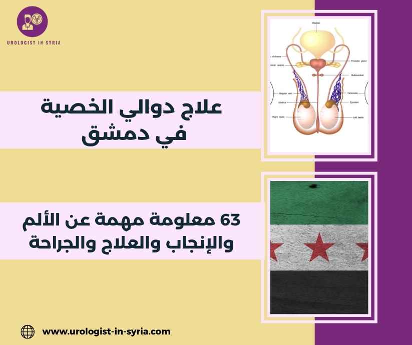 علاج دوالي الخصية في دمشق