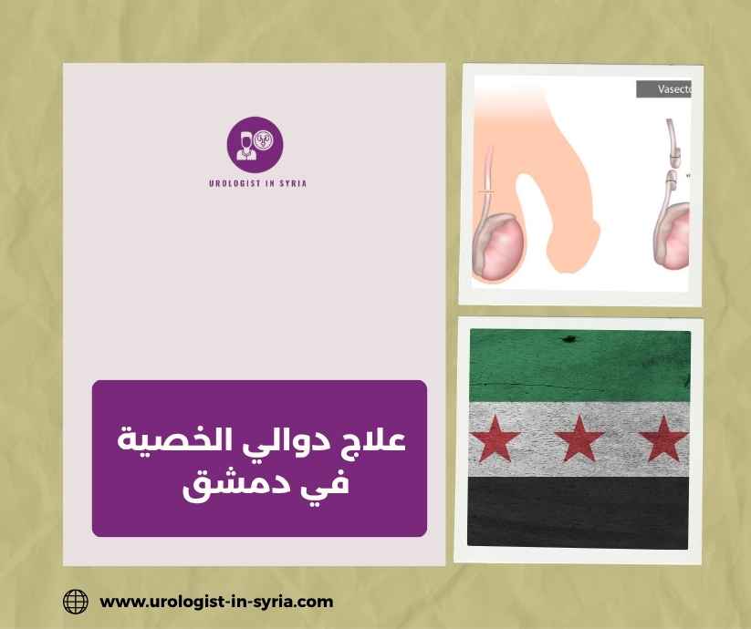 علاج دوالي الخصية في دمشق