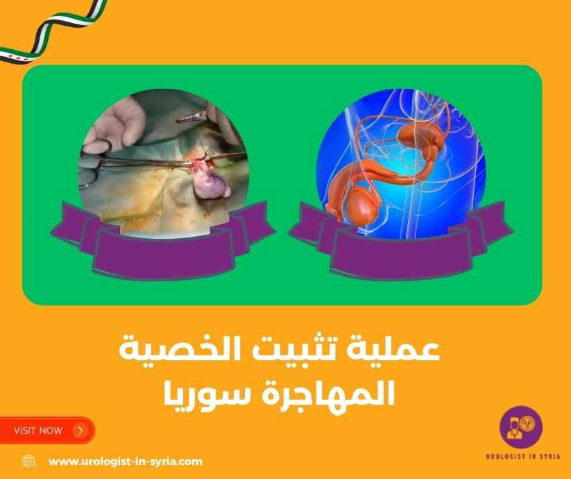 عملية تثبيت الخصية المهاجرة سوريا