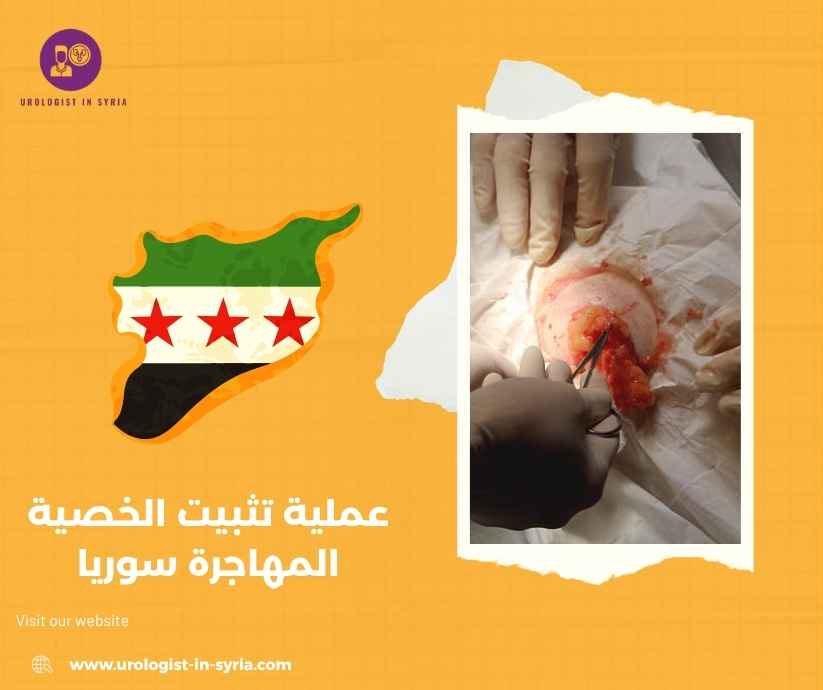 عملية تثبيت الخصية المهاجرة سوريا