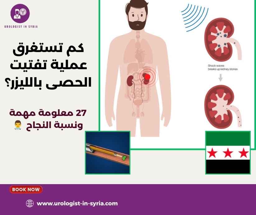 كم تستغرق عملية تفتيت الحصى بالليزر؟