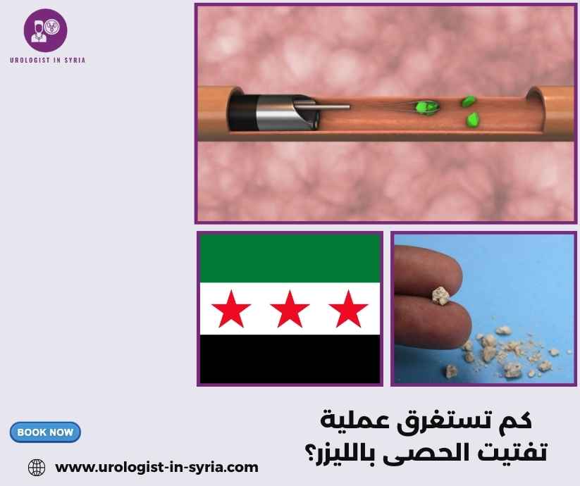 كم تستغرق عملية تفتيت الحصى بالليزر؟ كم تستغرق عملية تفتيت الحصى بالليزر؟