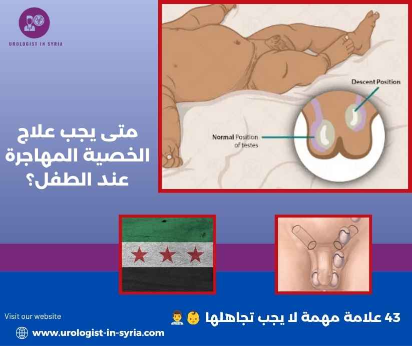 متى يجب علاج الخصية المهاجرة عند الطفل؟