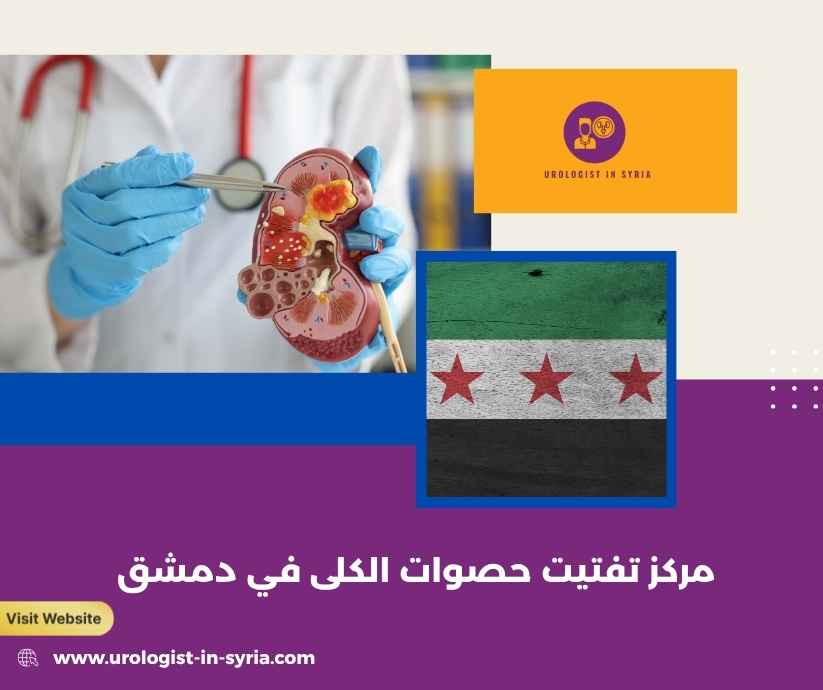 مركز تفتيت حصوات الكلى في دمشق مركز تفتيت حصوات الكلى في دمشق