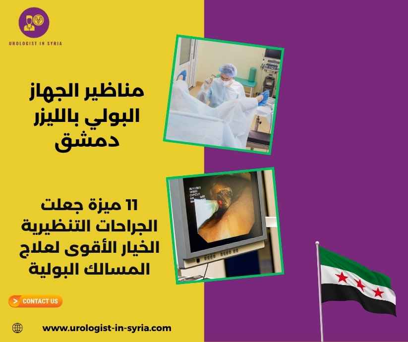 مناظير الجهاز البولي بالليزر دمشق