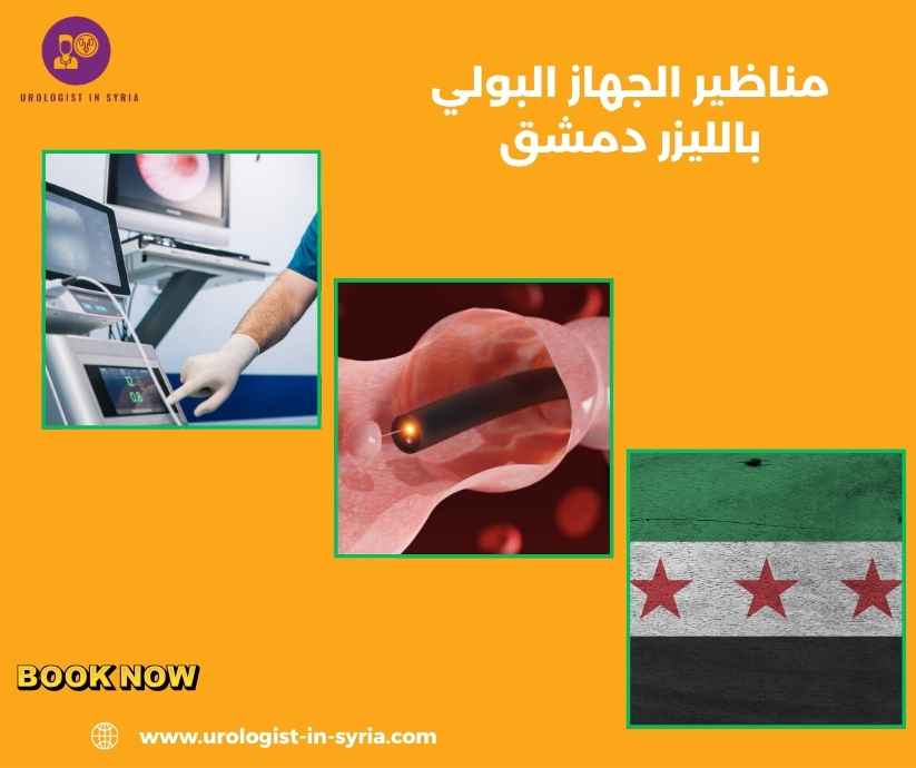 مناظير الجهاز البولي بالليزر دمشق مناظير الجهاز البولي بالليزر دمشق