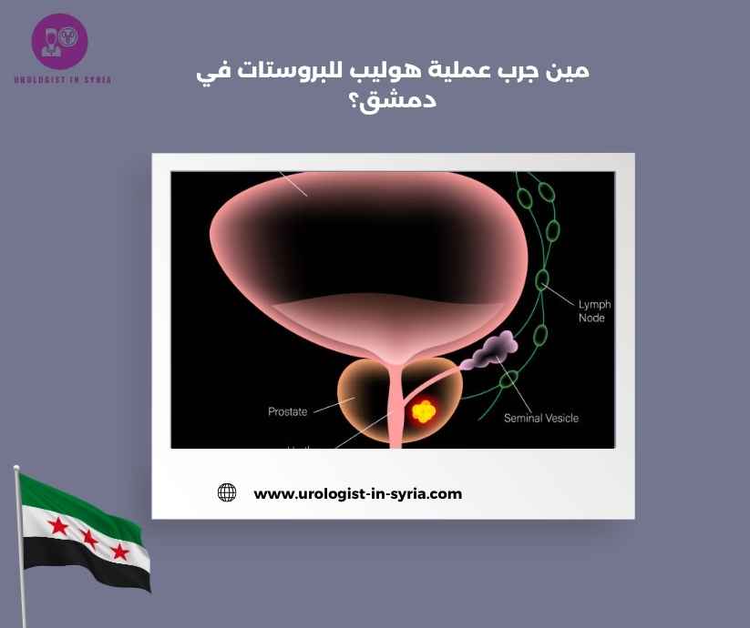 مين جرب عملية هوليب للبروستات في دمشق؟