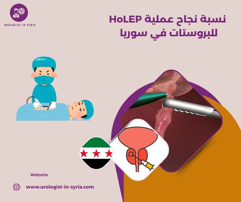 نسبة نجاح عملية HoLEP للبروستات في سوريا نسبة نجاح عملية HoLEP للبروستات في سوريا