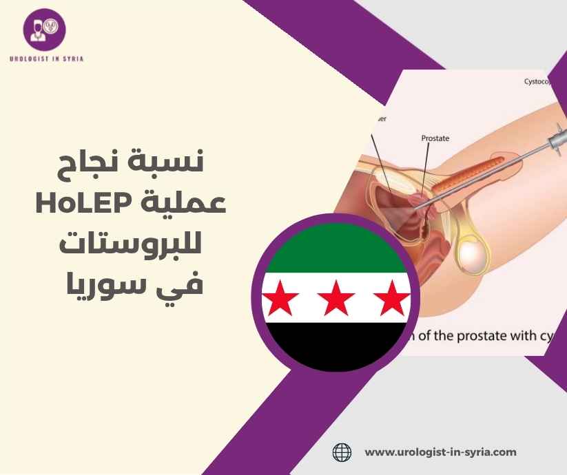 نسبة نجاح عملية HoLEP للبروستات في سوريا نسبة نجاح عملية HoLEP للبروستات في سوريا