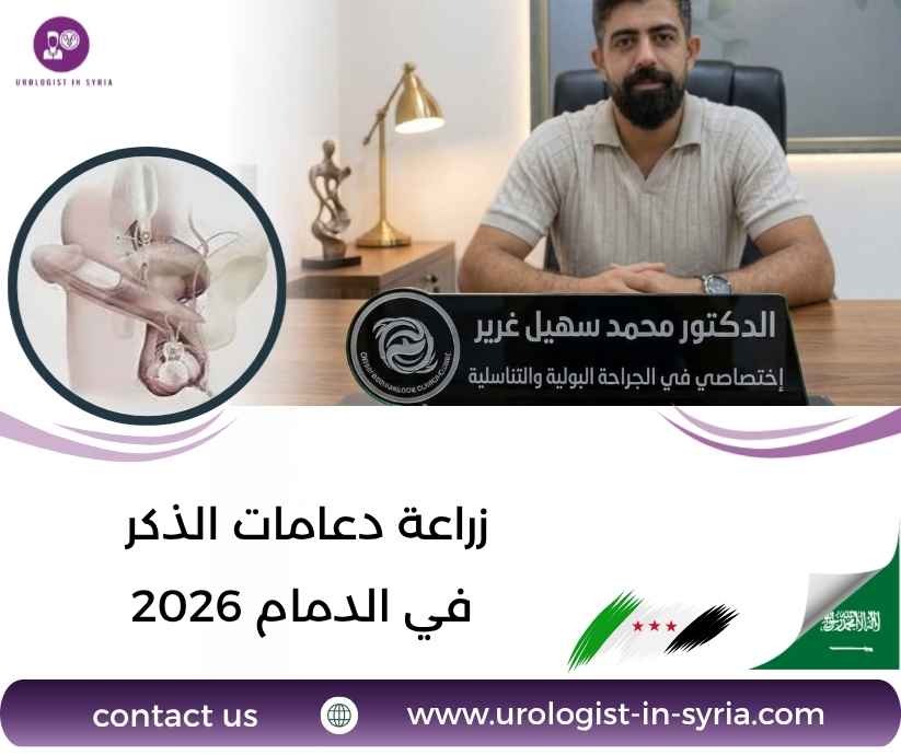 زراعة دعامات الذكر في الدمام 2026 زراعة دعامات الذكر في الدمام 2026